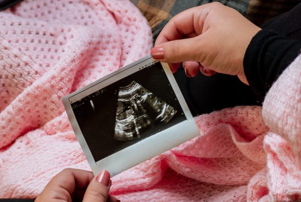 woman looking at baby sonogram